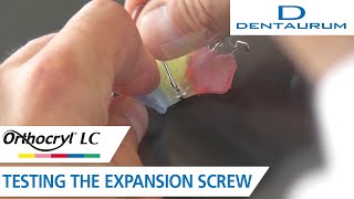 Orthocryl® LC – testing the expansion screw orthodontic appliance [upl. by Ailahs]