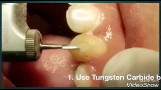 how to remove adhesive composite after debonding orthodontic brackets [upl. by Valle]