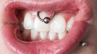 Smiley piercing  kolczyk w wędzidełku [upl. by Ahsekram]