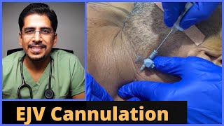 EJV External Jugular Vein Cannulation in 5 mins [upl. by Annavahs]