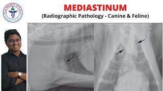 Mediastinum  Radiology  Lecture 13 [upl. by Calvert]