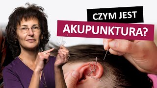 Czym jest akupunktura Czy akupunktura działa [upl. by Nilpik]