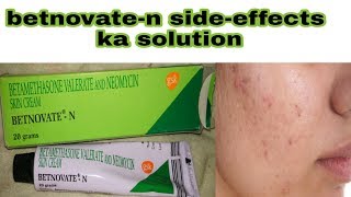 betnovate n cream ke sideeffects ka solution  how to use betnovate n cream  hindi [upl. by Nywroc]