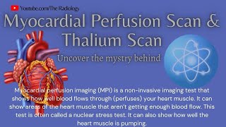 Myocardial Perfusion Scan amp Thallium Scan myocardialinfarction heartattack [upl. by Medwin898]