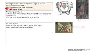 Seronegative Spondyloarthropathies  MSK  Step 1 Simplified [upl. by Adidnere740]