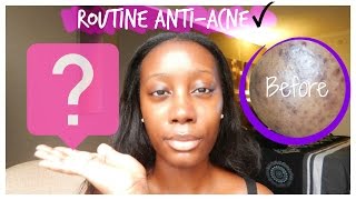 Routine soir  Acne Skin disease  Peau noire acnéique [upl. by Tyra]