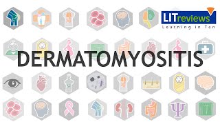 Dermatomyositis [upl. by Yerag]