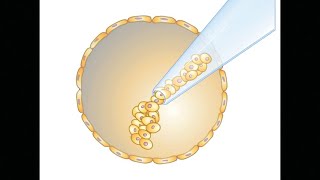 Embryonic Stem Cells and Somatic Cell Nuclear Transfer [upl. by Suruat31]