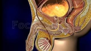 Urodynamic assessment  Animated Atlas of BPH and OAB [upl. by Anna-Diana]