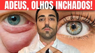 Como ELIMINAR BOLSAS nos OLHOS Oftalmologista Explica [upl. by Doty]