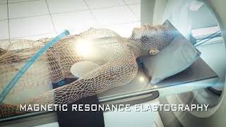 Fibroscan Device  Elastography  Trailer  Biomedical Engineers TV [upl. by Chandra]