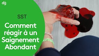 🔴HÉMORRAGIES GÉNITALES AU COURS DE LA GROSSESSE  hematome retroplacentaire  placenta previa [upl. by Ecienahs]