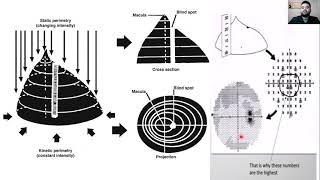 Campos Visuales en Glaucoma 2021 [upl. by Derdle]