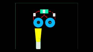 Relative Afferent Pupillary Defect RAPD [upl. by Nonnel]