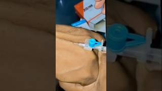 Cannula insertion 💉🩹  ivcannulation medical hospital medicine satyujribadiya doctor [upl. by Ynolem]