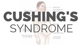 What is Cushing Syndrome  pathology symptoms causes diagnosis treatment [upl. by Sylado215]