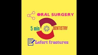 LEFORT FRACTURE LINES  ORAL SURGERY [upl. by Akeimat]