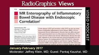 MR Enterography of Inflammatory Bowel Disease with Endoscopic Correlation [upl. by Anehsat]