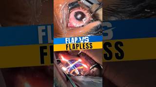 Difference Between Flap And Flapless Lasik Glasses Removal [upl. by Eiramnwad]