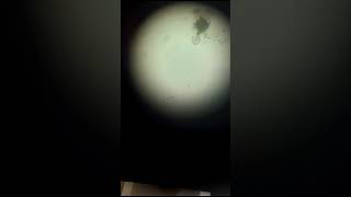 zooplankton in water experiment zoology insects science msc [upl. by Gerianne]