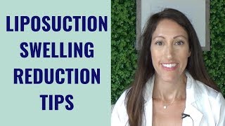 Liposuction Healing amp Recovery Tips  How to REDUCE Lipo Swelling  Post Liposuction Care Guide [upl. by Anaicul]