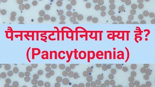 pancytopenia क्या है pancytopenia in Hindi [upl. by Nosittam357]