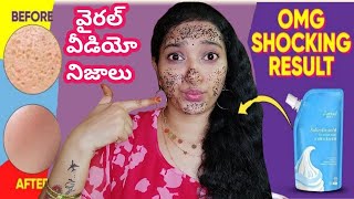 Salicylic Acid Mask in TeluguSalicylic Acid Ice Cream Mask Review in TeluguSalicylic acid icecream [upl. by Anigue]