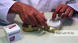 How to prepare a long term denture relining with Molloplast® B [upl. by Oicaro911]