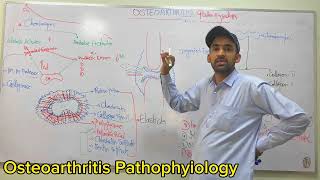 Osteoarthritis Pathophysiology Function of chondrocyte Hindi Urdu By IMTIAZ AFRIDI [upl. by Shorter]