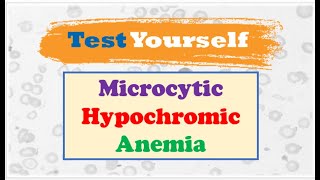 Diffrential Diagnosis 🔷 of Microcytic Hypochromic Anemia [upl. by Yarahs]