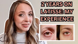 2 YEARS USING LATISSE MY RESULTS  Any Negative Side Effects Is It Worth The Money [upl. by Dyane]