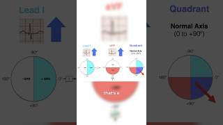 How to identify an axis deviation on an EKG ￼ [upl. by Marmaduke]