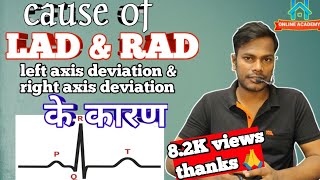 left axis deviation ecg  right axis deviation ecg in hindi  left axis deviation का कारण ecg ekg [upl. by Esekram]