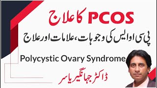 PCOS ka ilaj  Polycystic ovary syndrome  PCOS Kya Hai In Urdu  Hindi  DR JAHANGIR YASIR [upl. by Harley427]