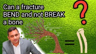 Can a fracture BEND and not BREAK a bone   Greenstick fracture  Tamil  தமிழ் [upl. by Romola183]