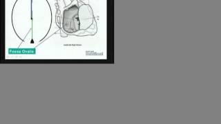 USMLE  Embryology of Heart  Part 1 [upl. by Enavi]