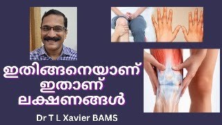 Dr T L Xaviers Shocking Rheumatic Fever Relief Discovery [upl. by Naxor]