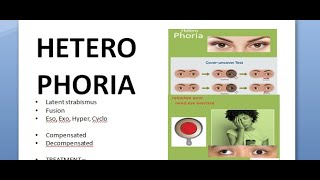 Ophthalmology 357 HeteroPhoria Latent Strabismus Squint Compensation DeCompensation [upl. by Pearlstein]