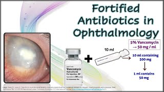 Fortified Antibiotics in Ophthalmology [upl. by Norma459]