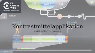 Kontrastmittelapplikation am CT Die Injektion am Terminal Part 3 [upl. by Chelton714]