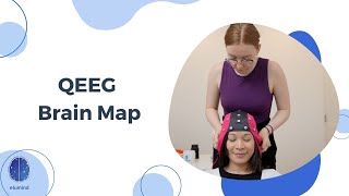 Benefits of QEEG Brain Mapping [upl. by Raddy]