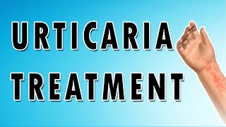 Urticaria Symptoms Treatment and Causes [upl. by Elyod588]