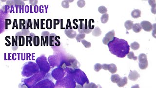 Paraneoplastic syndromes  Detailed explanation [upl. by Lekcar]