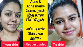 How I cleared my acne  My skincare routine for Acne amp Acne marks  Best products for pimple skin [upl. by Kerril]