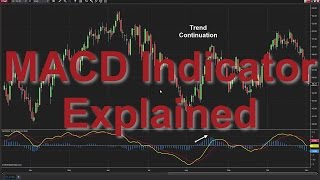 How to Use the MACD Indicator Moving Average Convergence Divergence [upl. by Byron]