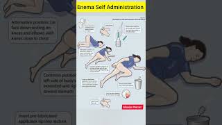 enema self administration।।enemaviralshortsyoutubeshorts shortsmedicalmedicalprocedure [upl. by Dorn]