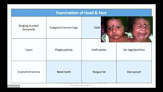 Targeted Neonatal Examination in Busy Practice  Dr V Anand [upl. by Bergess]