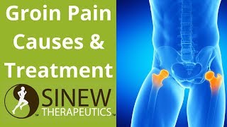 Groin Pain Causes and Treatment [upl. by Enneyehc]