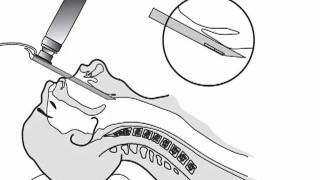 Laryngoscope Blade Use In ETI [upl. by Antsirhc376]