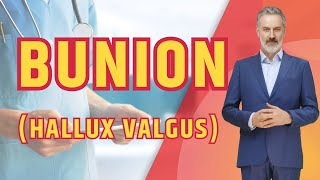 What is BUNION Hallux Valgus The Truth About Bunions [upl. by Tonl]